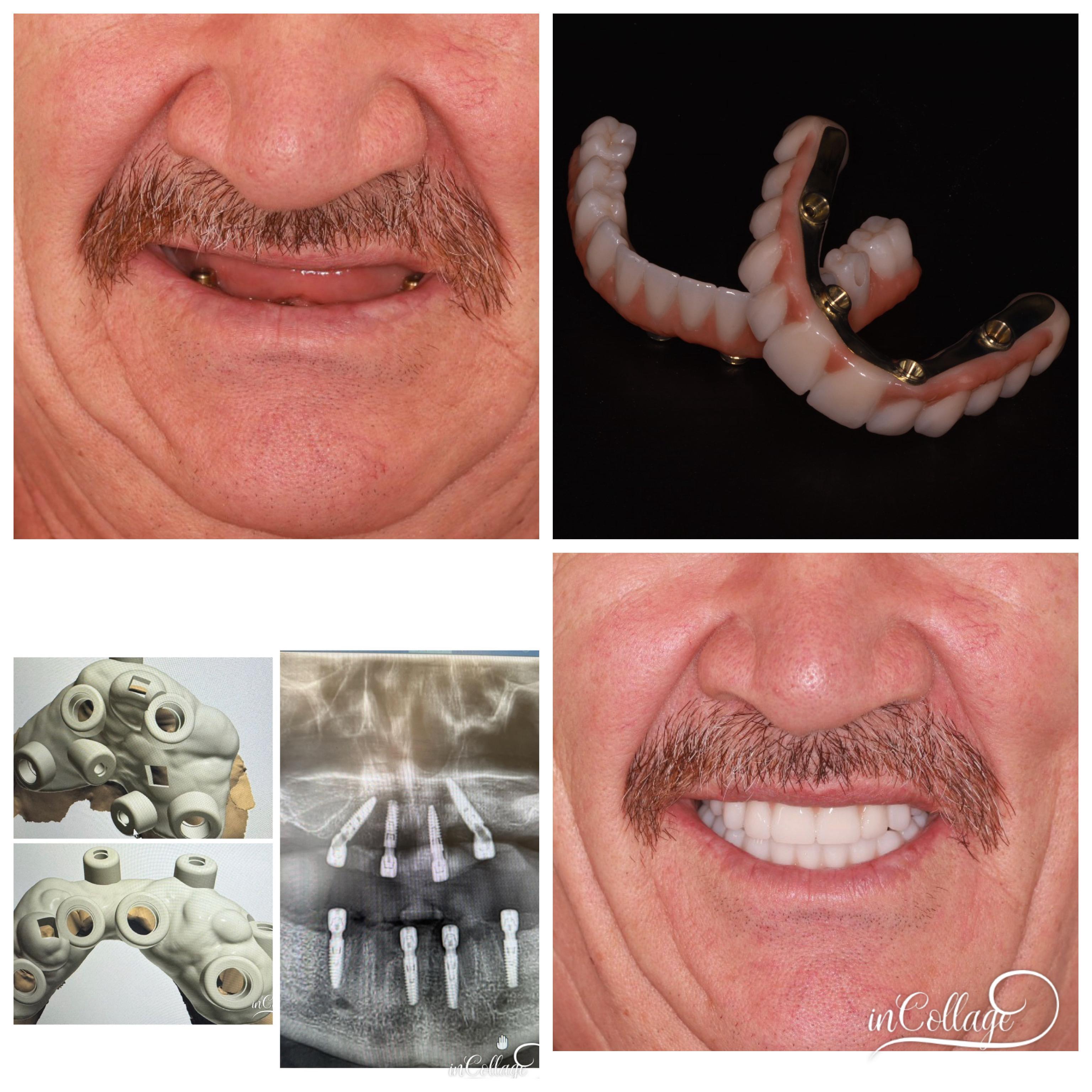 Image title